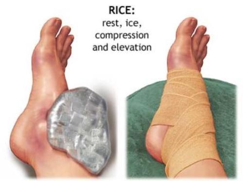 RICE – Phương pháp sơ cứu và điều trị cơ bản các chấn thương thể thao