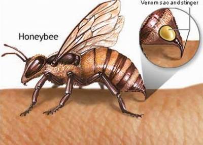 Sơ cứu khi bị ong đốt
